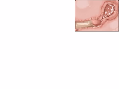 ev_hapy_bc_ct02