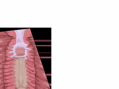 ev_kobura_ct03