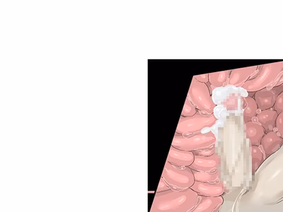 ev_lusia_ct02