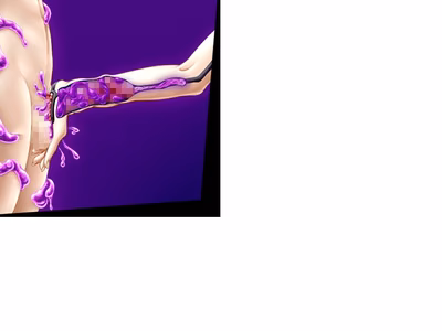 ev_vitae_ct15