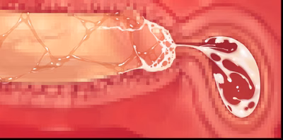 1401