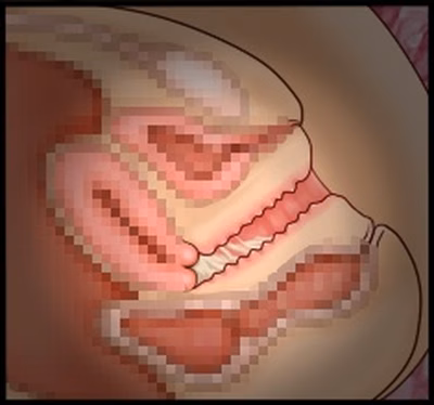 CG10a_01