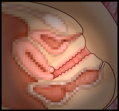 CG10a_01b