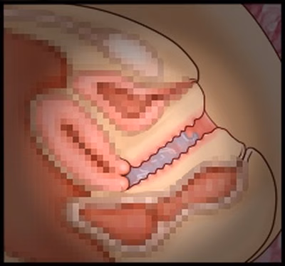 CG10a_01c
