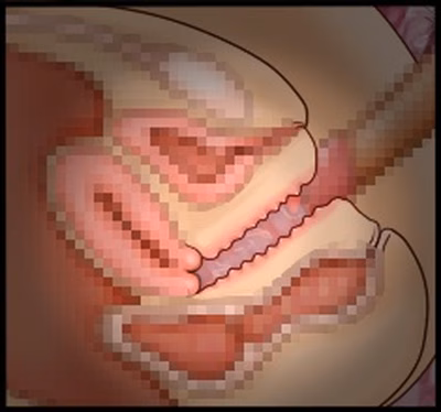 CG10a_08b