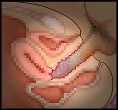 CG10a_10b