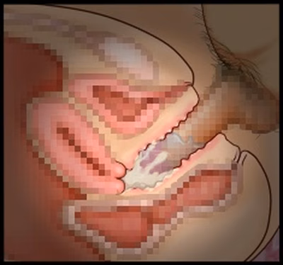 CG10a_11b